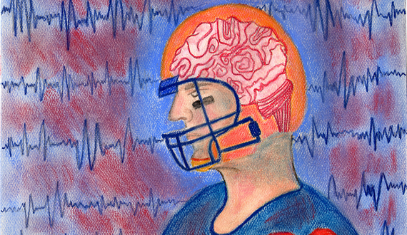 Tracking and handling concussions in college football is left to schools. Doctors think that should change.