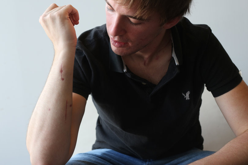 Out of the darkness: After surviving Aurora shooting, recent SU graduate refocuses on the future
