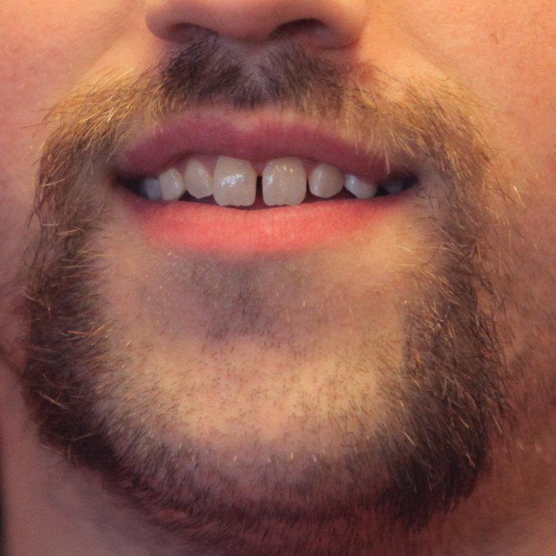 A hairy good cause: Syracuse company takes opportunity to grow some ‘staches for brave young boy