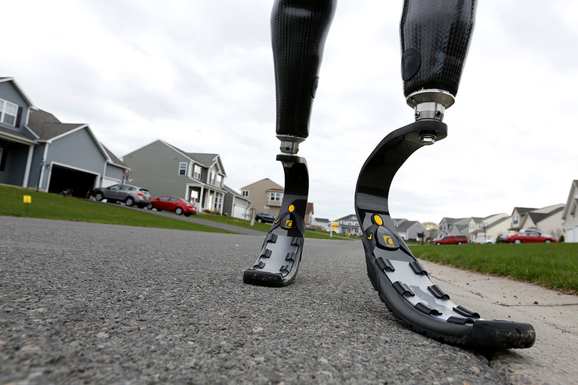 Lonergan had both legs amputated after the accident and spent four days in a medically induced-coma. Before receiving his first pair of prosthetic legs, he spent a few months in a wheelchair.