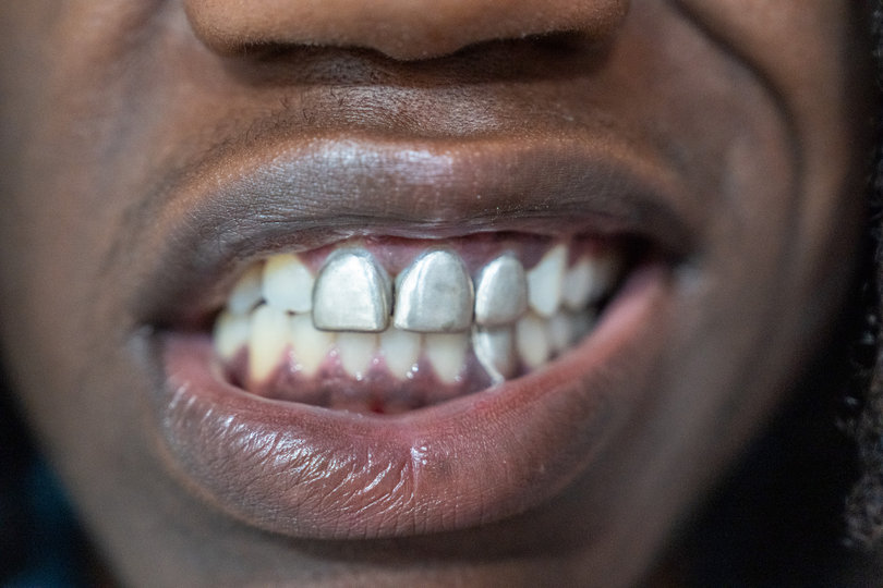 Syracuse University senior Seydou Diao designs grillz sets while also balancing his studies as a mechanical engineering student. All of his orders go through his Instagram account, @imakegrills.